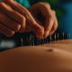 Acupuncture and Physiotherapy in Milton